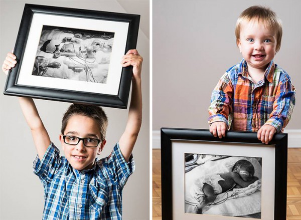 15 мощных «До и после» фотографий недоношенных детей